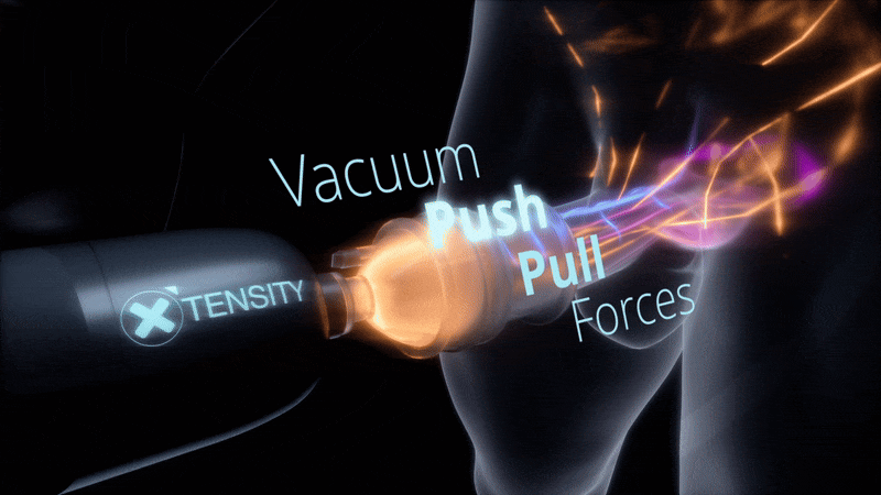 Xtensity™ High-Performance Pleasure Device